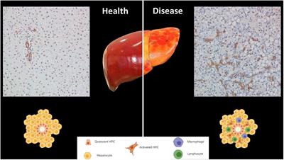 Redox Control of the Immune Response in the Hepatic Progenitor Cell Niche